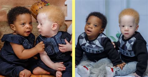 Twins Born With Different Skin Colors Leads to Wonderful Situation for This Family