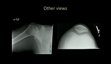 MSK - MSK Radiology - (Roco) $$$ Flashcards | Quizlet