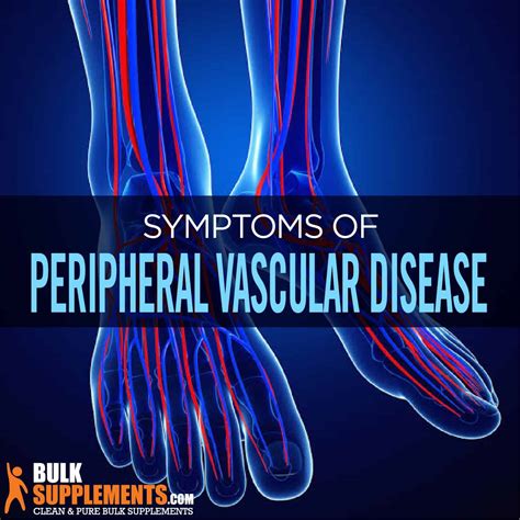 Peripheral Vascular Disease: Symptoms, Causes & Treatment