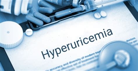 Hyperuricemia and Its Causes - Facty Health