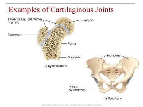 09 [chapter 9 joints]