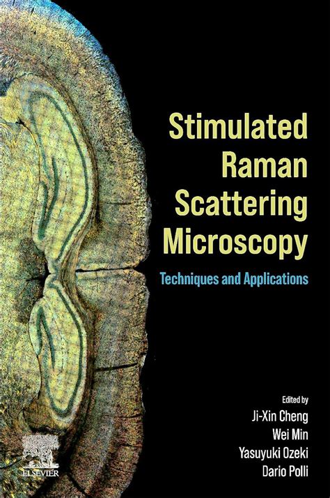 Amazon.com: Stimulated Raman Scattering Microscopy: Techniques and Applications: 9780323851589 ...