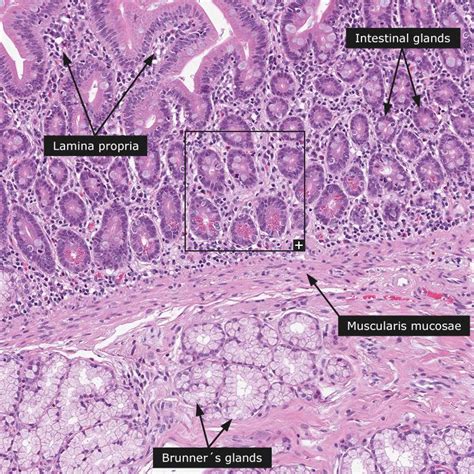 Dictionary - Normal: Duodenum - The Human Protein Atlas | Dictionary ...