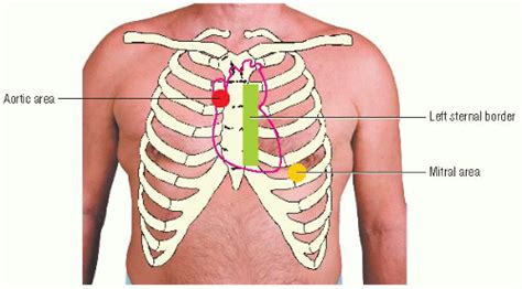 What Is A Soft Ejection Systolic Murmur - BEST HOME DESIGN IDEAS