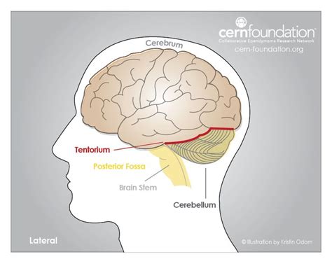 The image shows a side (lateral) view of the tentorium cerebelli – an extension of the dura ...