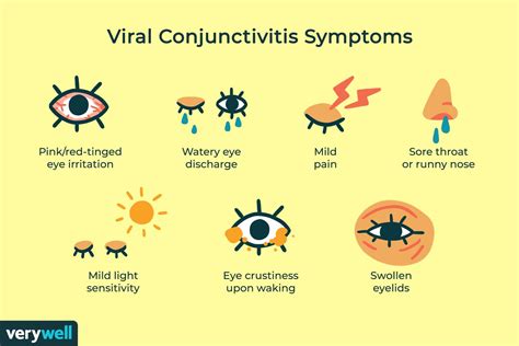 Viral Conjunctivitis (Pink Eye): Symptoms, Causes, Remedies