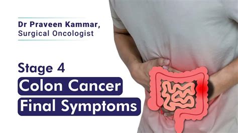 How to Spot the Last Symptoms of Colon Cancer | Dr. Praveen Kammar