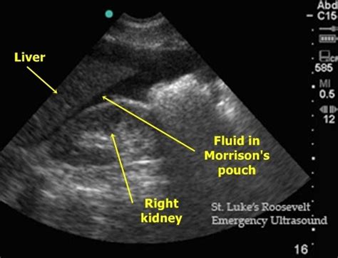 ECC EDUCATION: Monthly Online Case Presentation (MOC) November 2013: 'Biker Like an Icon'