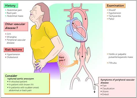 Aortic Aneurysm - Cardiac Nursing School | Aortic aneurysm, Abdominal aortic aneurysm, Cardiac ...