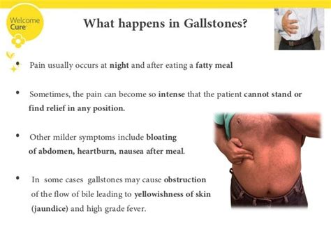 gallbladder pain symptoms images - usseek.com