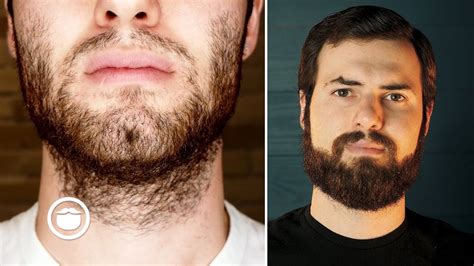 How To Grow A Beard