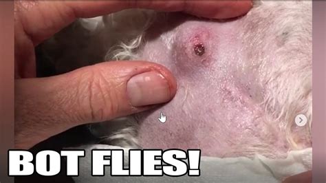 Bot Fly Removal! Top 10 Bot Fly Removal of All Time! - YouTube