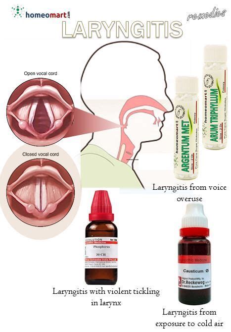 How to cure a hoarse voice naturally laryngitis treatment fast and ...