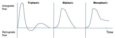 Monophasic Vs Biphasic Waveforms Ultrasound