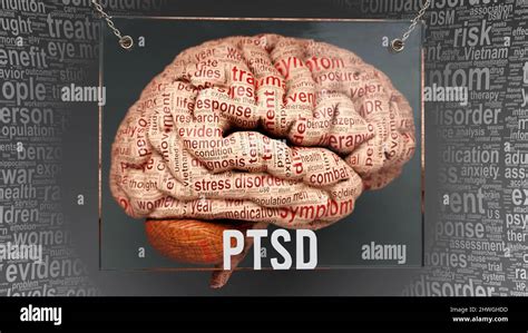 Ptsd anatomy - its causes and effects projected on a human brain revealing Ptsd complexity and ...