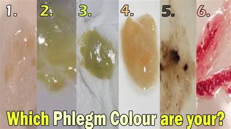 what does the color of phlegm mean healthsites in 2020 health chart - what does the color of ...
