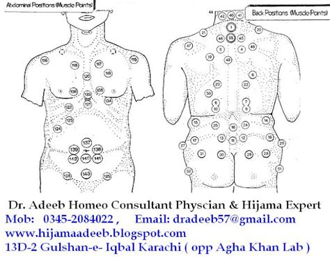 HIJAMA ( Blood Cupping ): Hijama Points