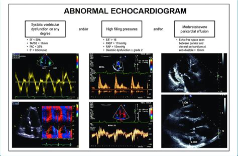 -Criteria for abnormal echocardiogram. TAPSE: tricuspid annular plane... | Download Scientific ...