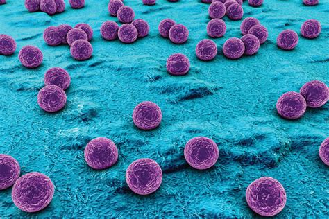 Prevention and Control of a Staphylococcus Aureus Infection ...