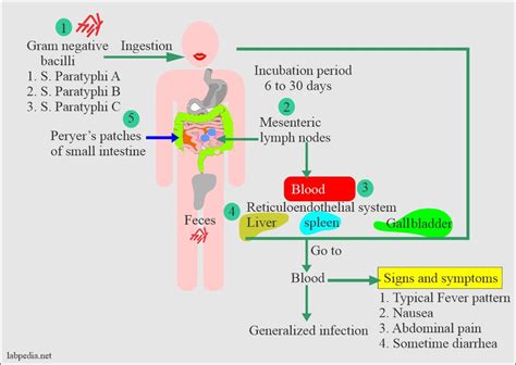 Enteric fever – part 2 – Paratyphoid fever, Salmonella paratyphi – Labpedia.net