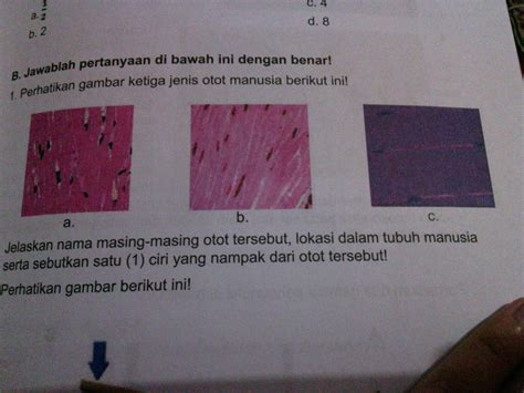 Detail Perhatikan Gambar Ketiga Jenis Otot Manusia Berikut Ini Koleksi ...