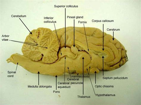 Sagittal Section -lateral ventricle (sheep's brain) http://classroom.sdmesa.edu/bbrothers/images ...