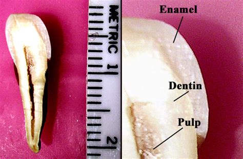 Tooth enamel - wikidoc