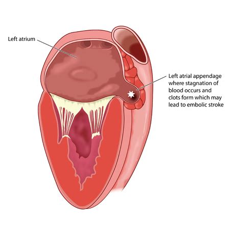 Vector of Section through heart showing - ID:92762623 - Royalty Free ...