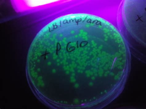 Bacterial Transformation | Results of our transformation lab… | Flickr
