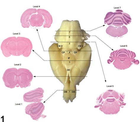 mouse brain atlas 3d