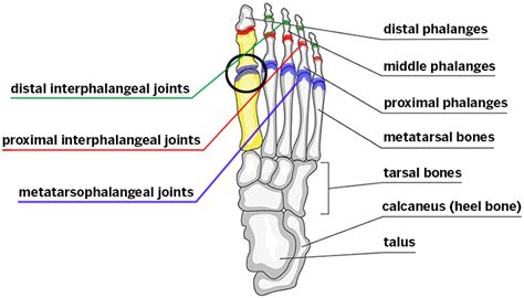 Hallux Rigidus (Stiff Big Toe) - HSS.edu