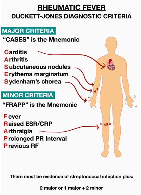 Rheumatic Fever Diagnostic Criteria Mnemonics | Medical Junction