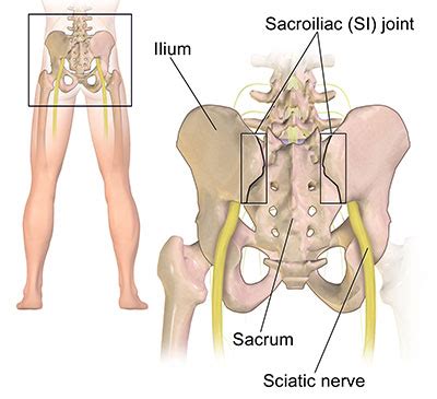 Sciatic Symptoms and The Flip Test | Sciatica Diagnosis