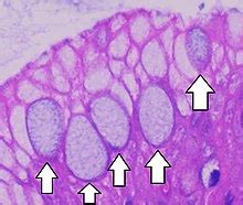 Goblet hücresi - Goblet cell - qaz.wiki