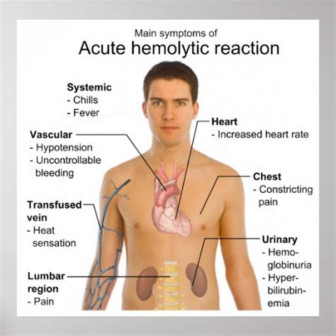 Symptoms of Acute Hemolytic Transfusion Reaction Poster | Zazzle