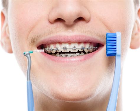 Tips for Brushing Your Teeth with Braces – Somos Dental