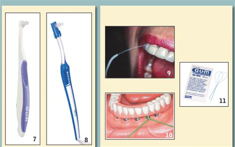 GUM® End-tuft Brush (Courtesy of Sunstar Americas, Inc.) Figure... | Download Scientific Diagram