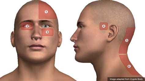 Differential Diagnosis of Headache