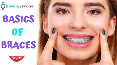 How to choose the best Braces for teeth? Dental Braces | Bookmyscans - YouTube