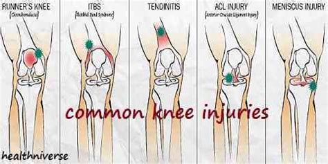 Pain on Inside of Knee: Causes & Treatment | HealthNiverse