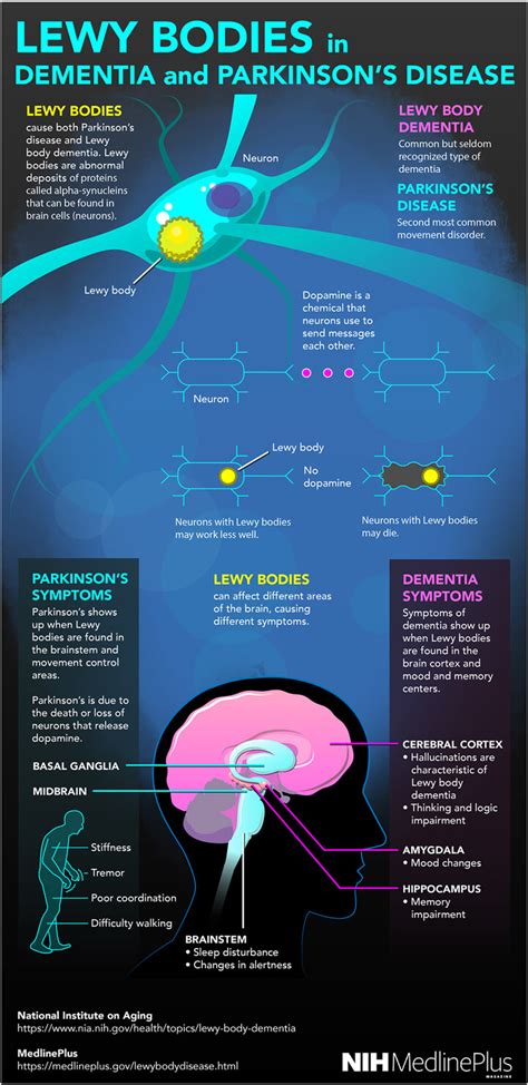 Lewy Bodies Dementia | NIH MedlinePlus Magazine