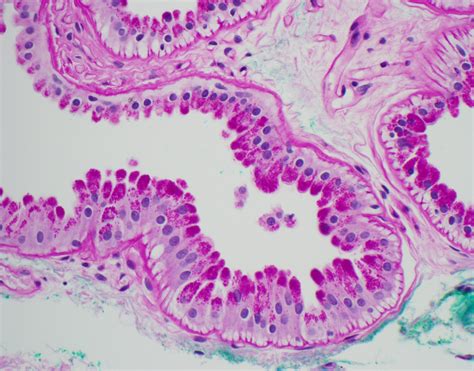 Apocrine Gland