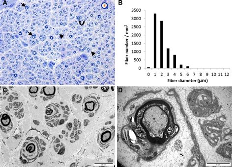 Histology of the distal sural nerve. (A) Transverse semi-thin section... | Download Scientific ...