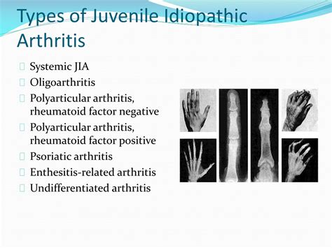 Juvenile Idiopathic Arthritis