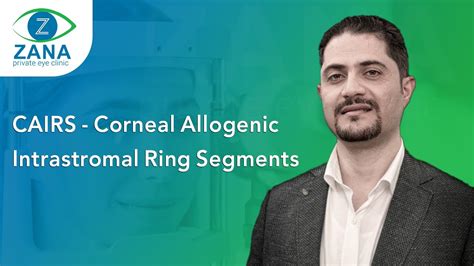 Corneal Allogenic Intrastromal Ring Segment (CAIRS) - YouTube