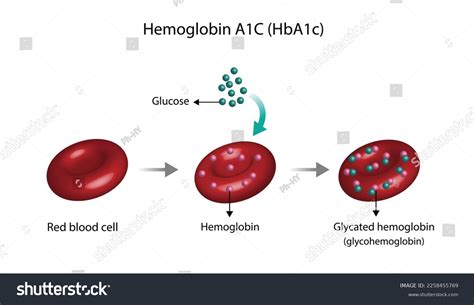 Hemoglobin A1c Hba1c Blood Glycated Hemoglobin Stock Vector (Royalty ...