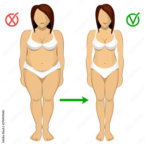 Fat and slim women. Woman body correction. Liposuction. Fitness. Fat ...