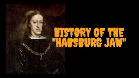 History Of The Habsburg Jaw - Prognathism in the House of Habsburg ...