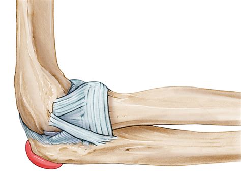 Olecranon bursitis