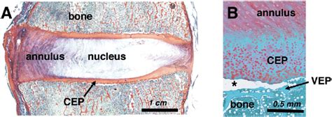 Annulus Fibrosus Histology